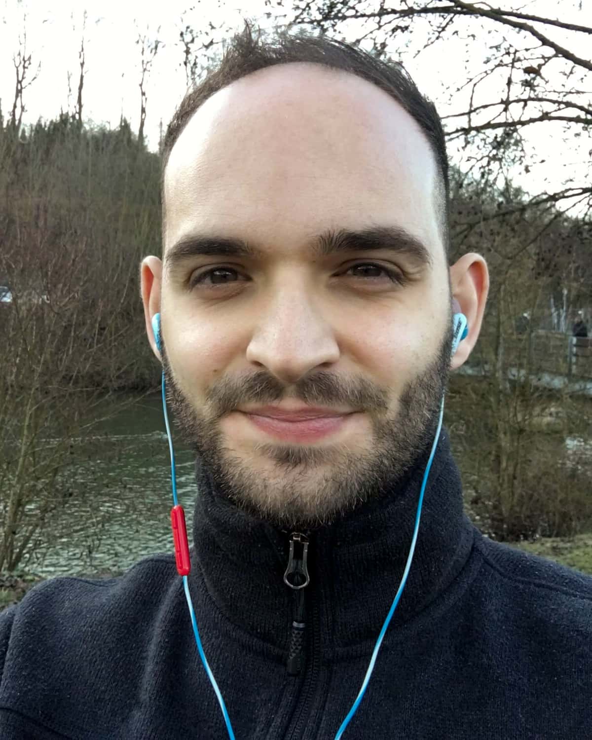 Junger Mann mit Haarausfall