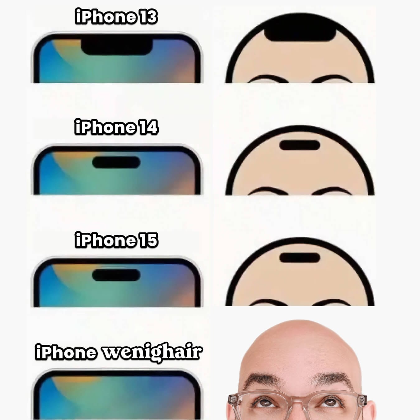 Meme vergleicht iPhone-Modelle von 13 bis 15 mit "iPhone wenighair", zeigt Entwicklung der Notch bis zur Glatze. Humorvoller Blick auf Haarausfall.