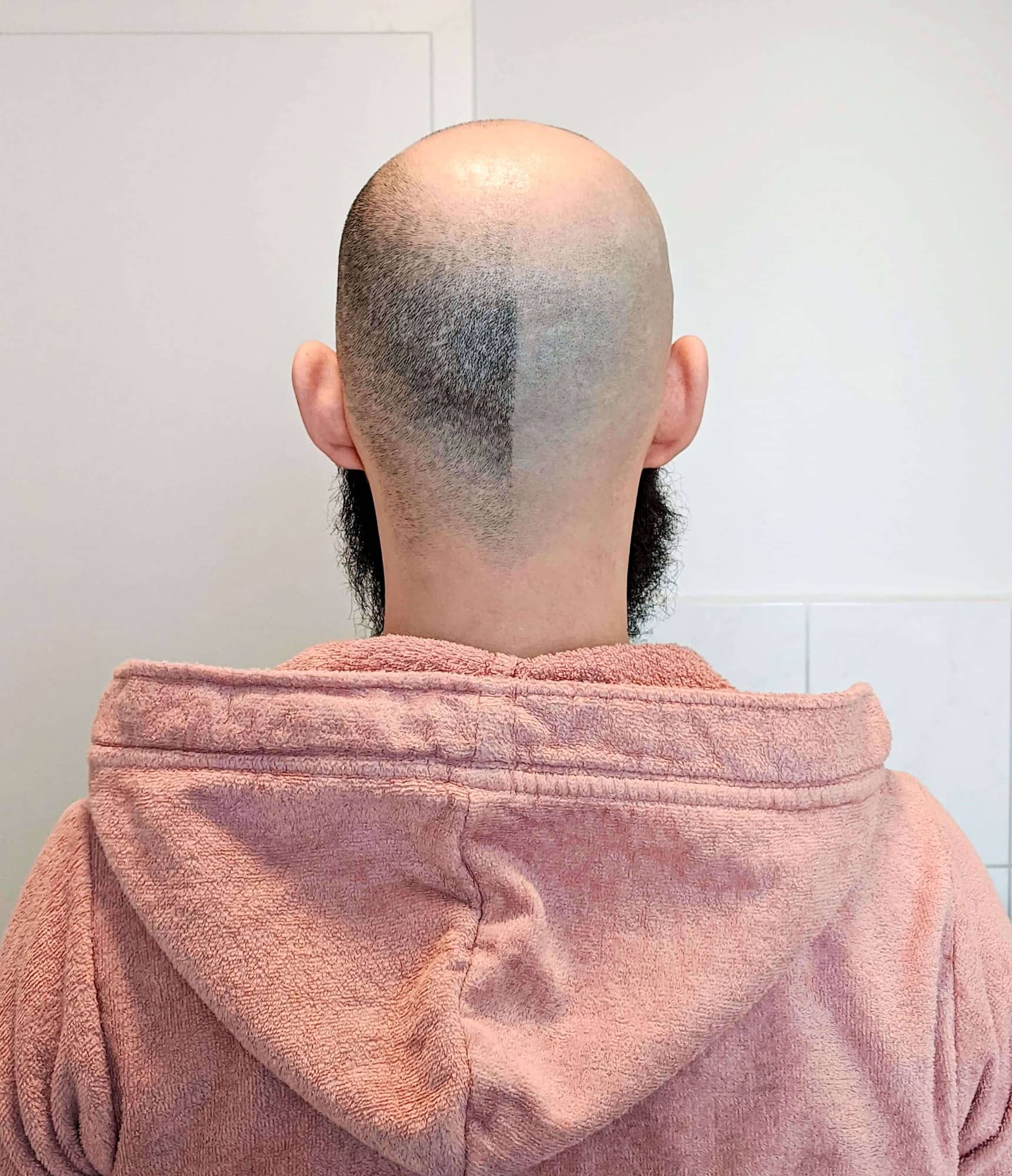 Rückansicht meiner frisch rasierten wenighair-Glatze – ein entscheidender Moment in meiner Glatze vorher nachher Transformation zur Freiheit