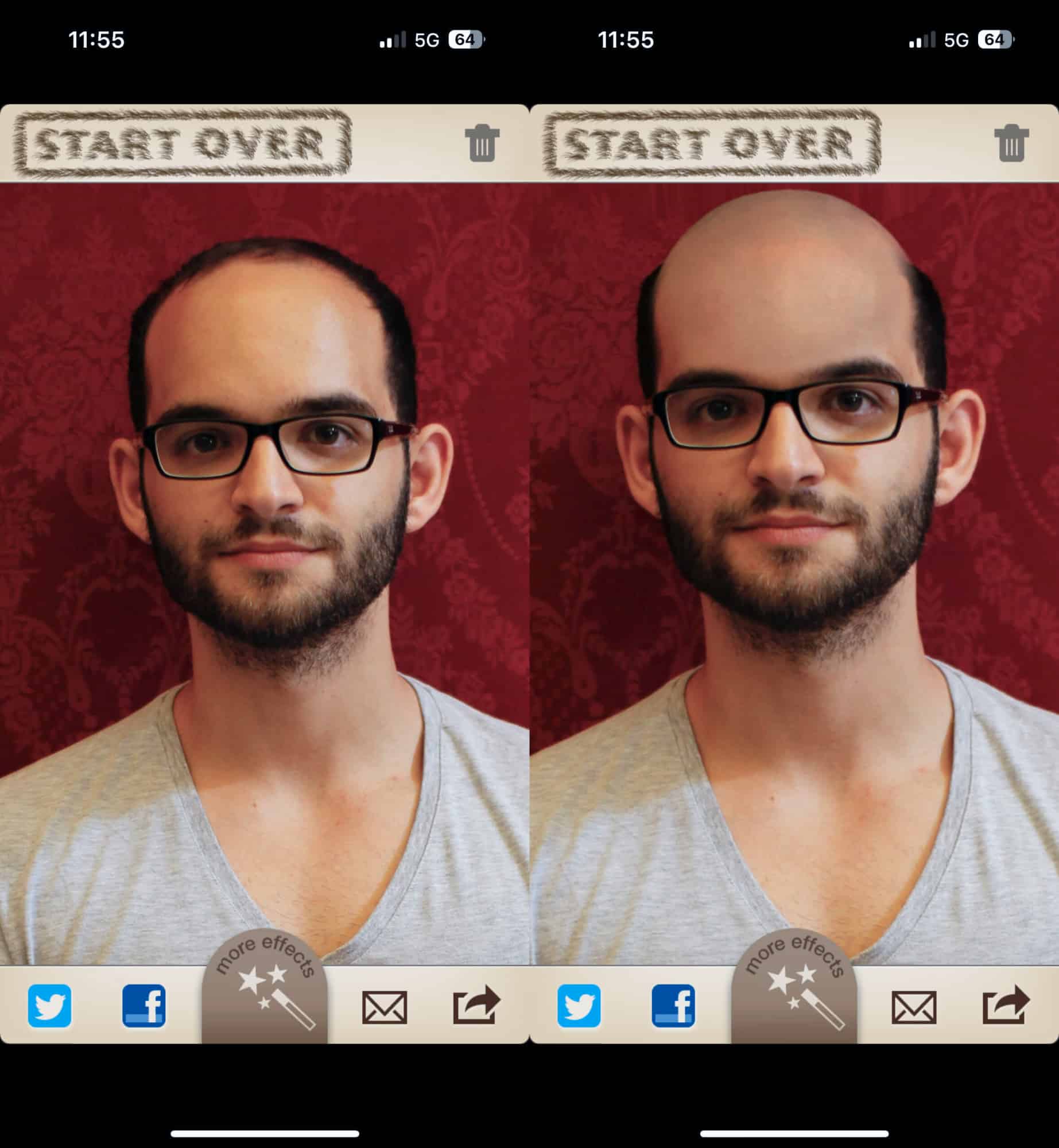 Verzerrte Darstellung einer Glatzen-App-Simulation im Vergleich – warum digitale Vorher-Nachher-Bilder bei der Glatzen-Entscheidung täuschen