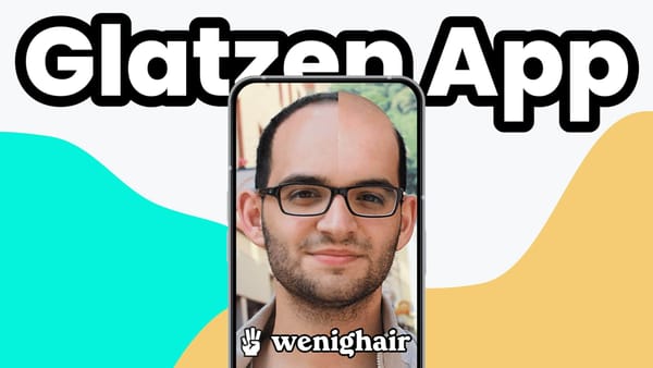 Smartphone zeigt Glatzen App "wenighair" mit Bild eines Mannes mit Glatze als Vorher Nachher Glatze vergleich