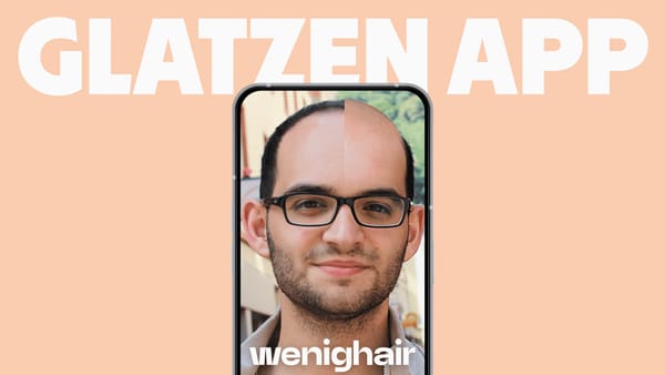 Smartphone zeigt Glatzen App "wenighair" mit Bild eines Mannes mit Glatze als Vorher Nachher Glatze vergleich