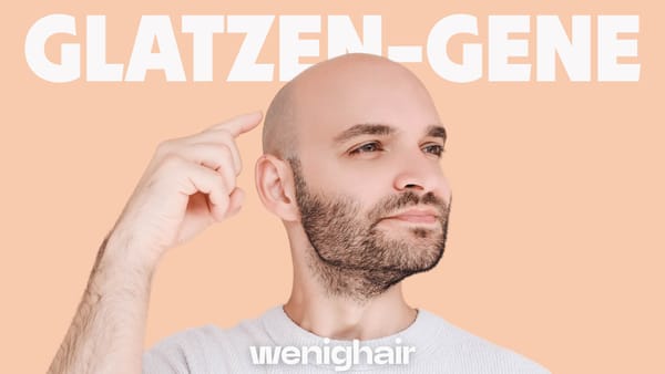 Selbstbewusster Mann mit Glatze zeigt auf "Glatzen-Gene" Schriftzug, symbolisieren Akzeptanz bei Haarausfall-Vererbung.